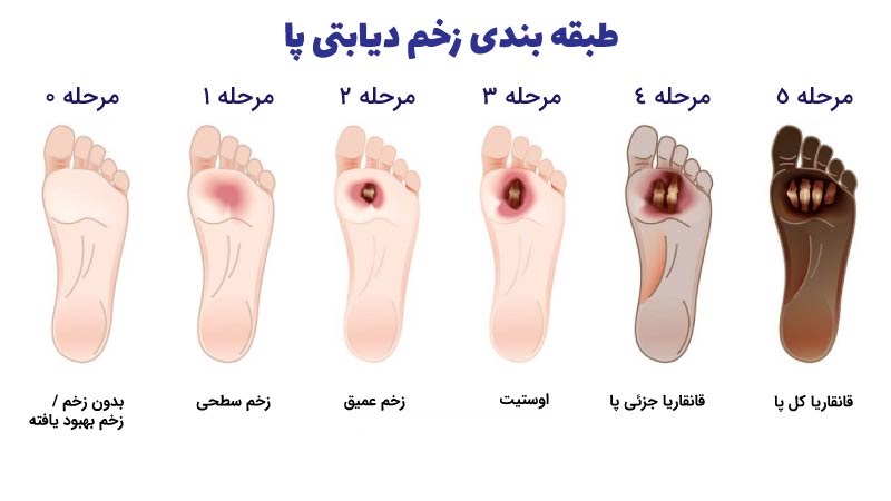 چشم انداز ها